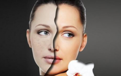 簡(jiǎn)單的祛痘方法，讓你的皮膚時(shí)刻光滑細(xì)嫩